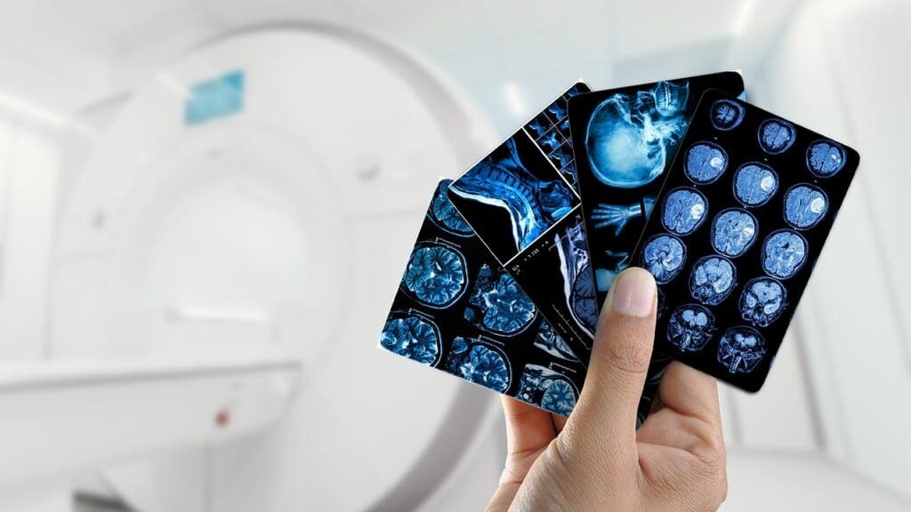 mri report interpretation