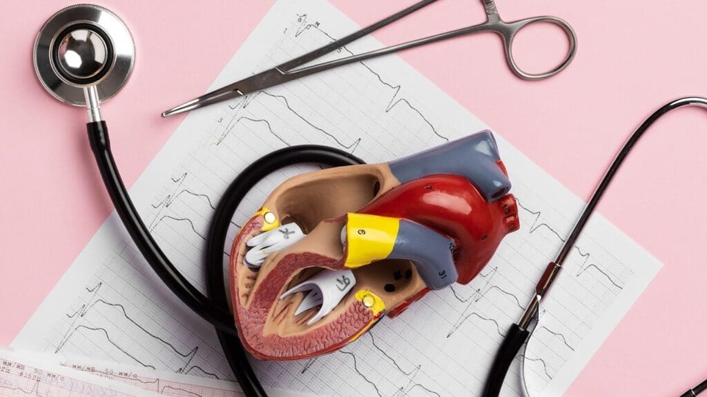 mv annuloplasty procedure