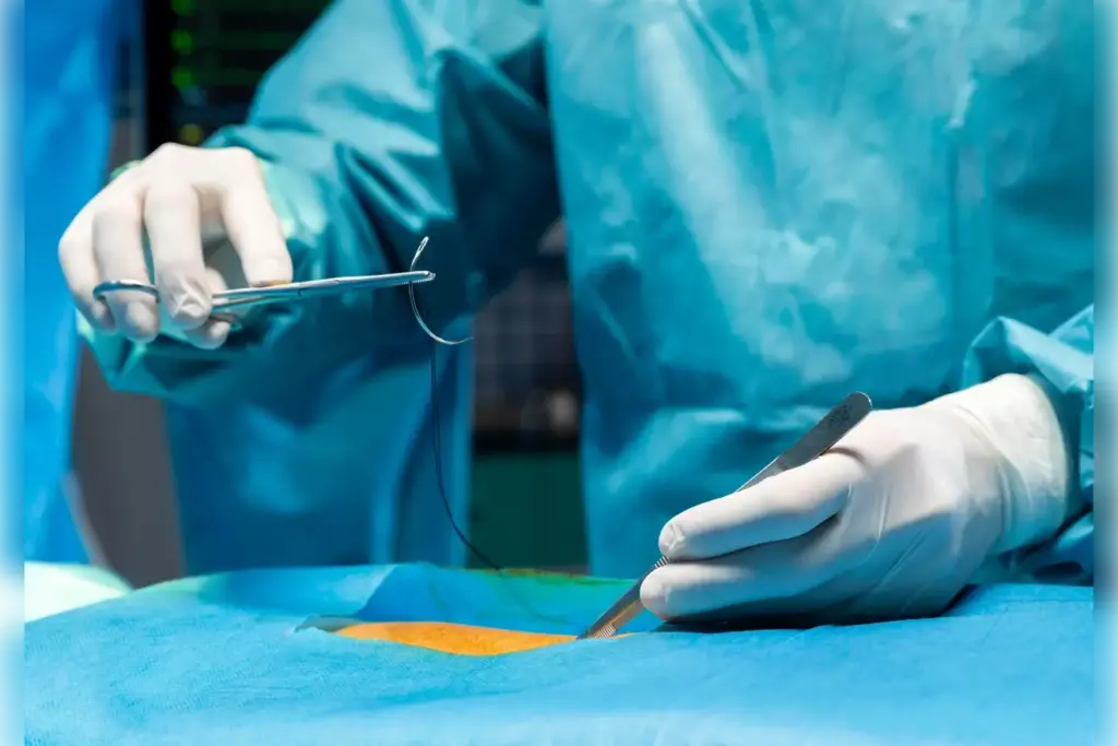 non invasive heart valve replacement non invasive heart valve replacement