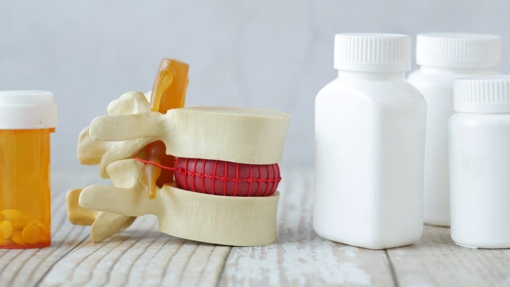 osteoarthritis and ibuprofen