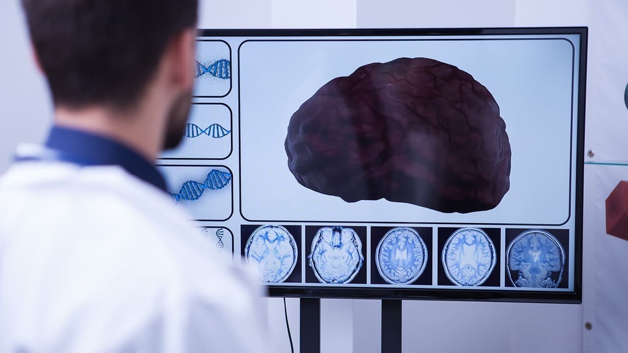 pontine tumors in adults