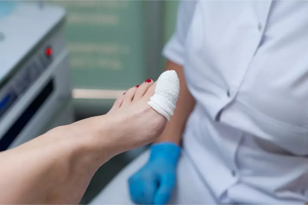 post bunion surgery recovery