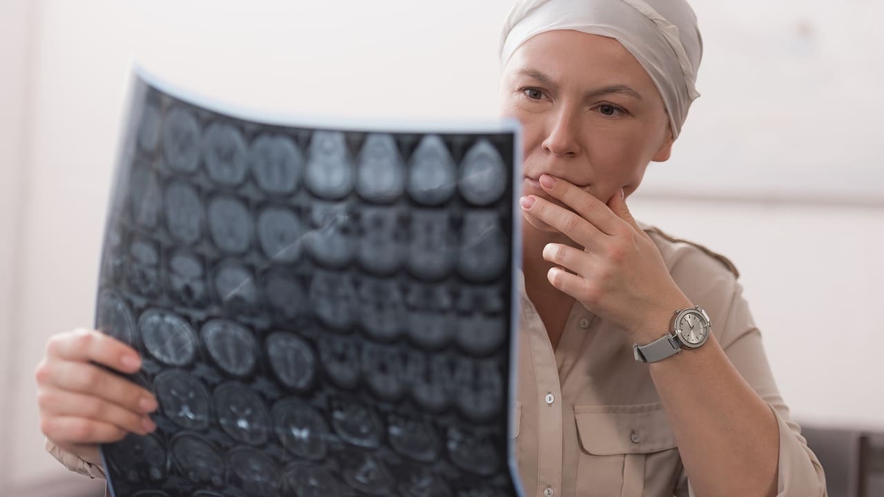 quality of life after brain tumor surgery