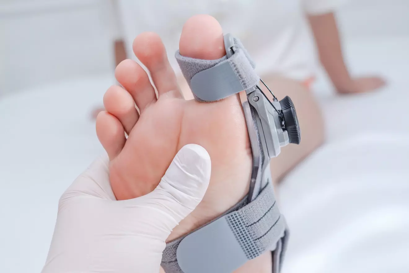 recover from bunion surgery