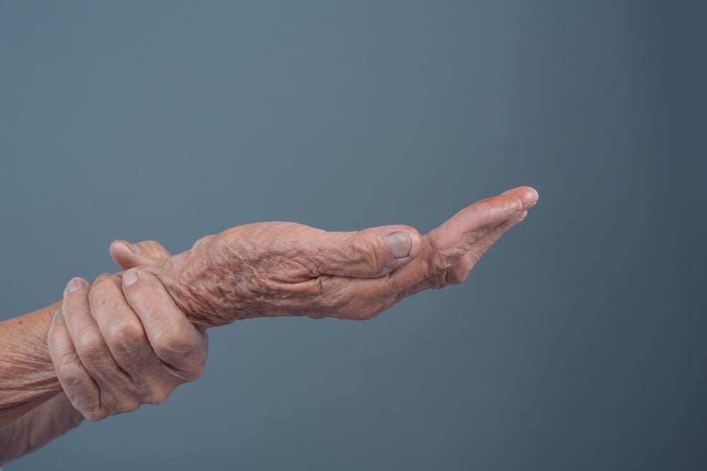 rheumatoid arthritis rheumatoid arthritis