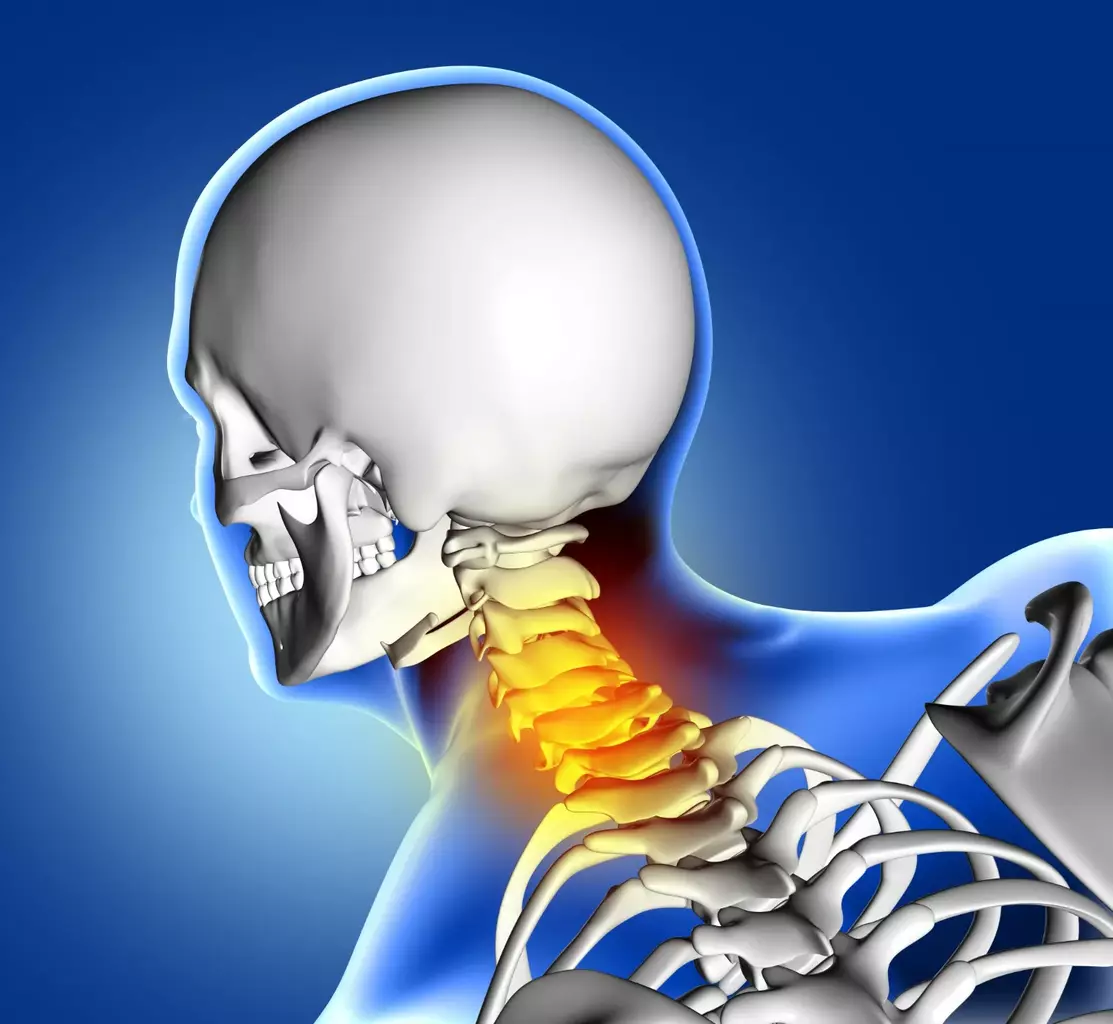 spinal fusion cervical spine
