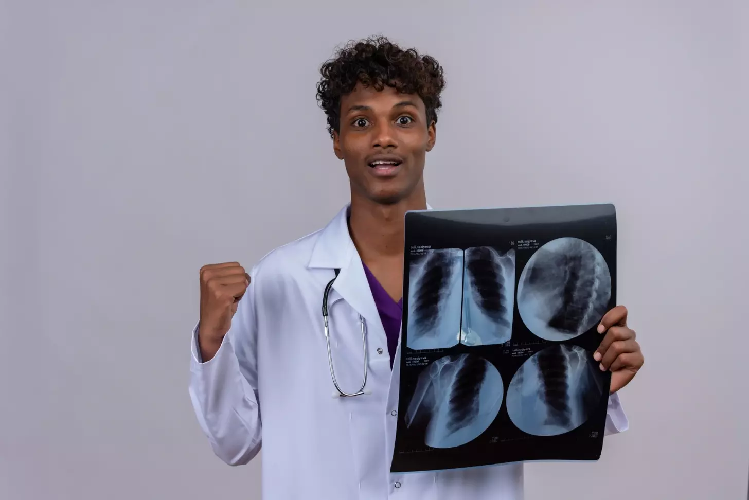 squamous cell lung cancer