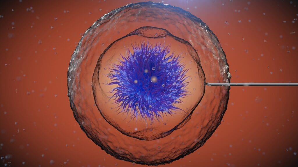 stem cell transplant stem cell transplant