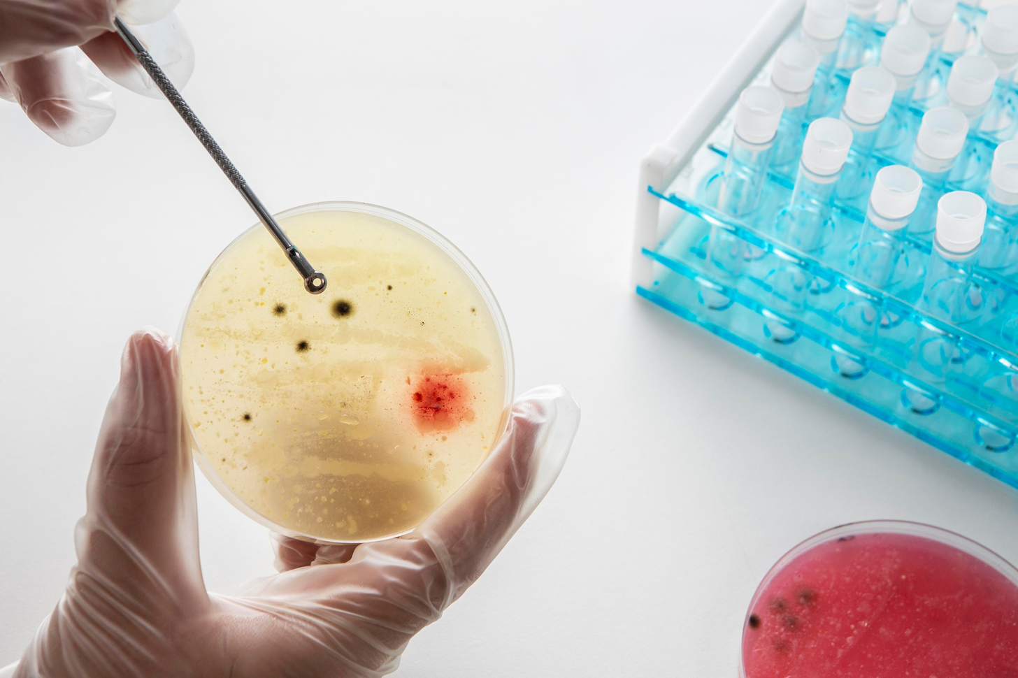 stem cell treatment for leukaemia