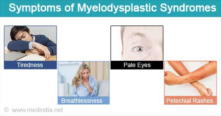 symptoms of myelodysplastic syndromes LIV Hospital