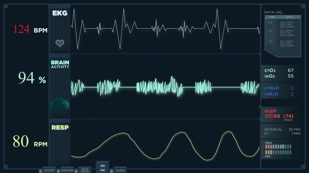 tachycardia bradycardia