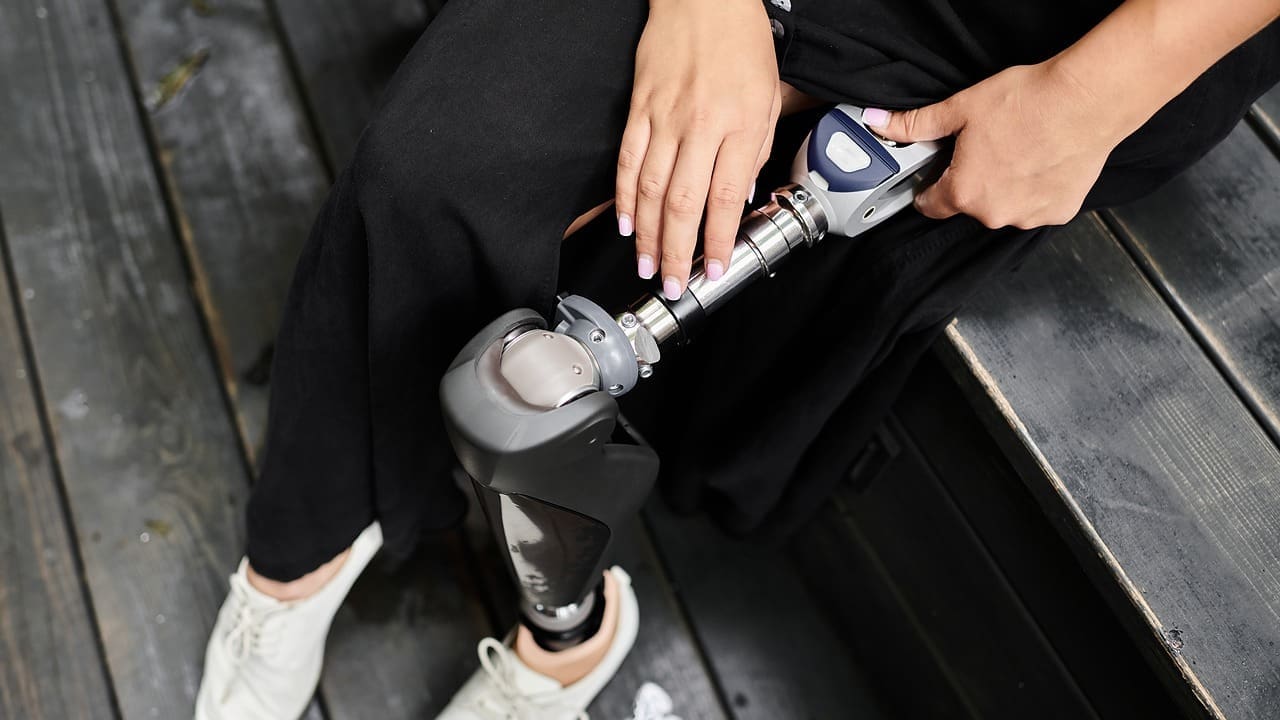 titanium knee prosthesis