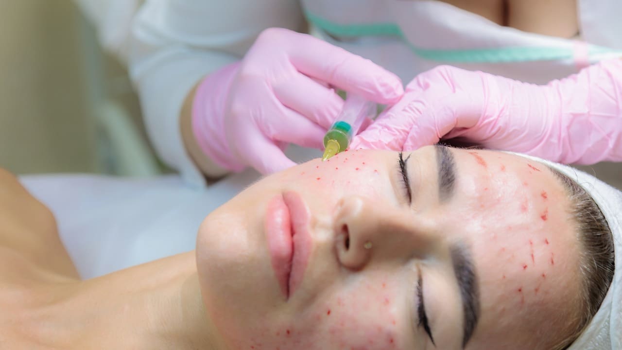 treatment for basal cell skin cancer on face