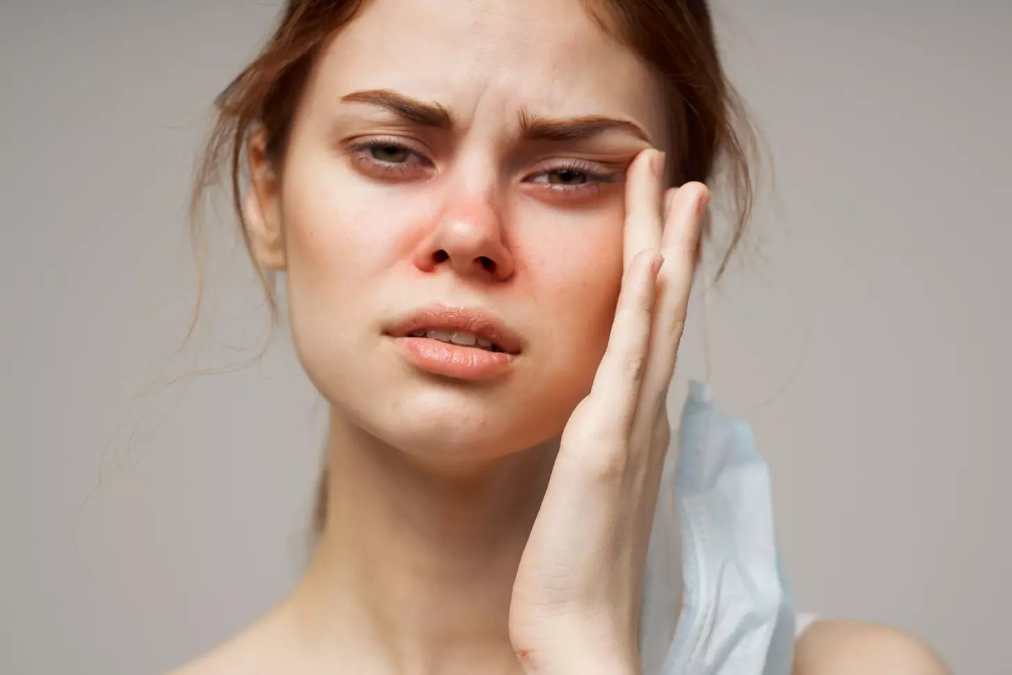 trigeminal neuralgia type 2