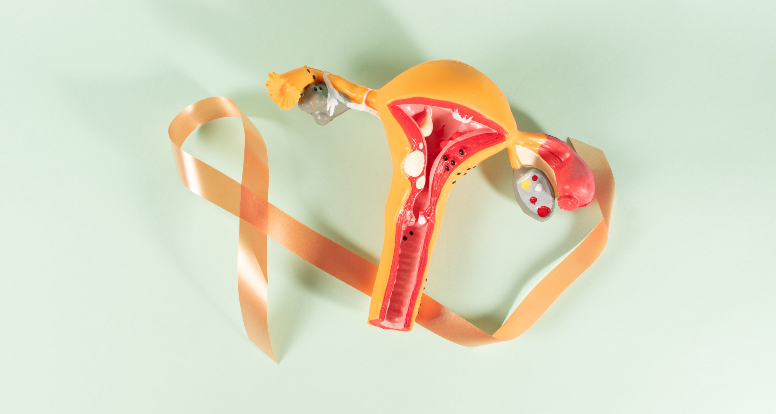 biggest symptom of ovarian cancer