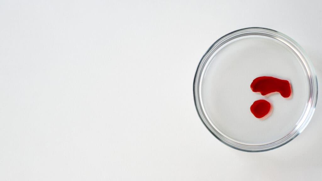 view laboratory test tube samples 4 1 LIV Hospital