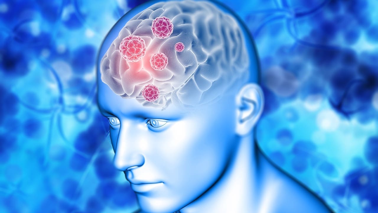 what causes a cyst on the brain
