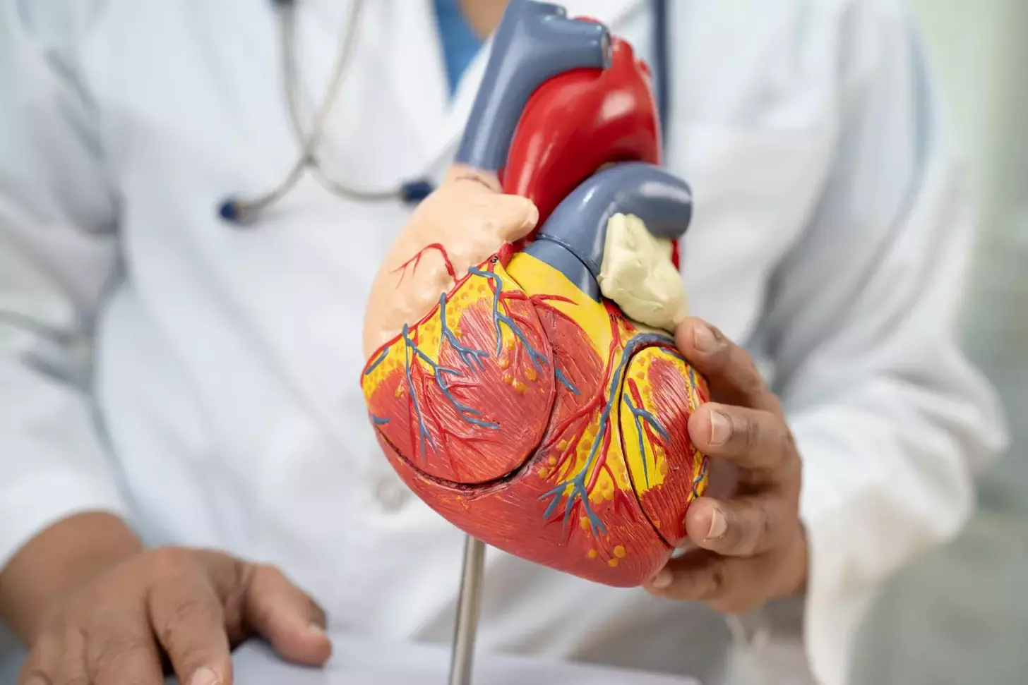 what does mi stand for in medical terms