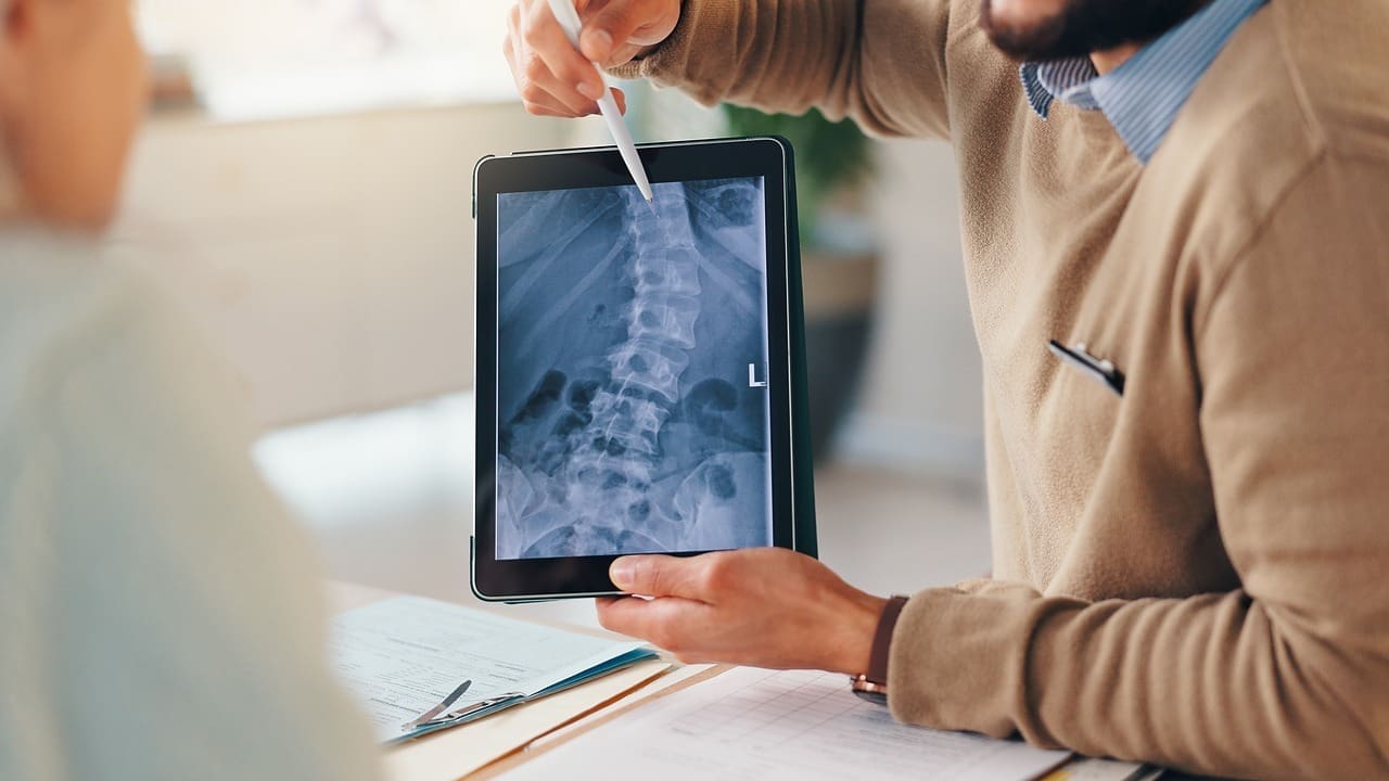 11 Best Alternatives to Spinal Fusion: Options for Stenosis, Spondylolisthesis & More