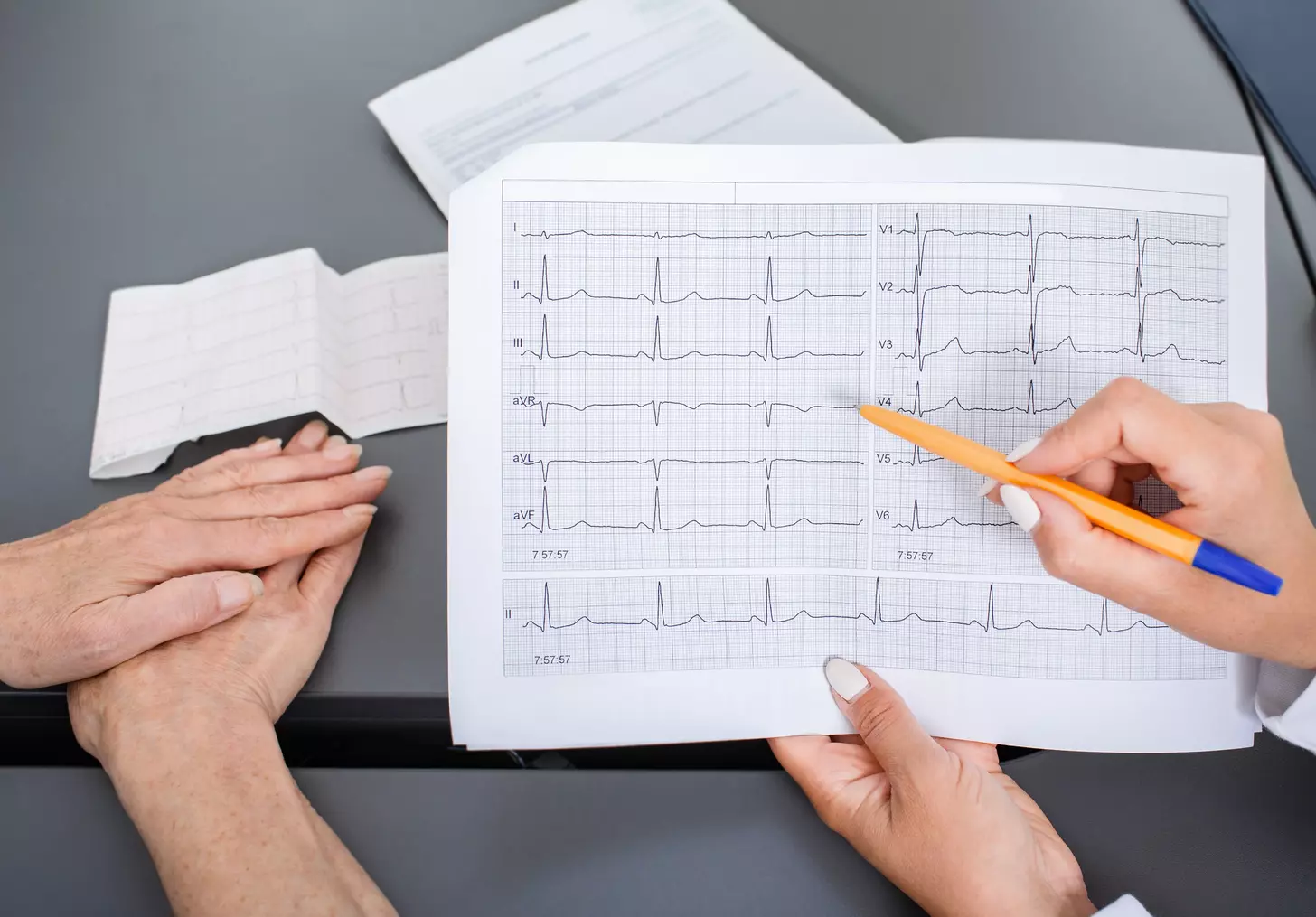 what is atrial fibrillation flutter