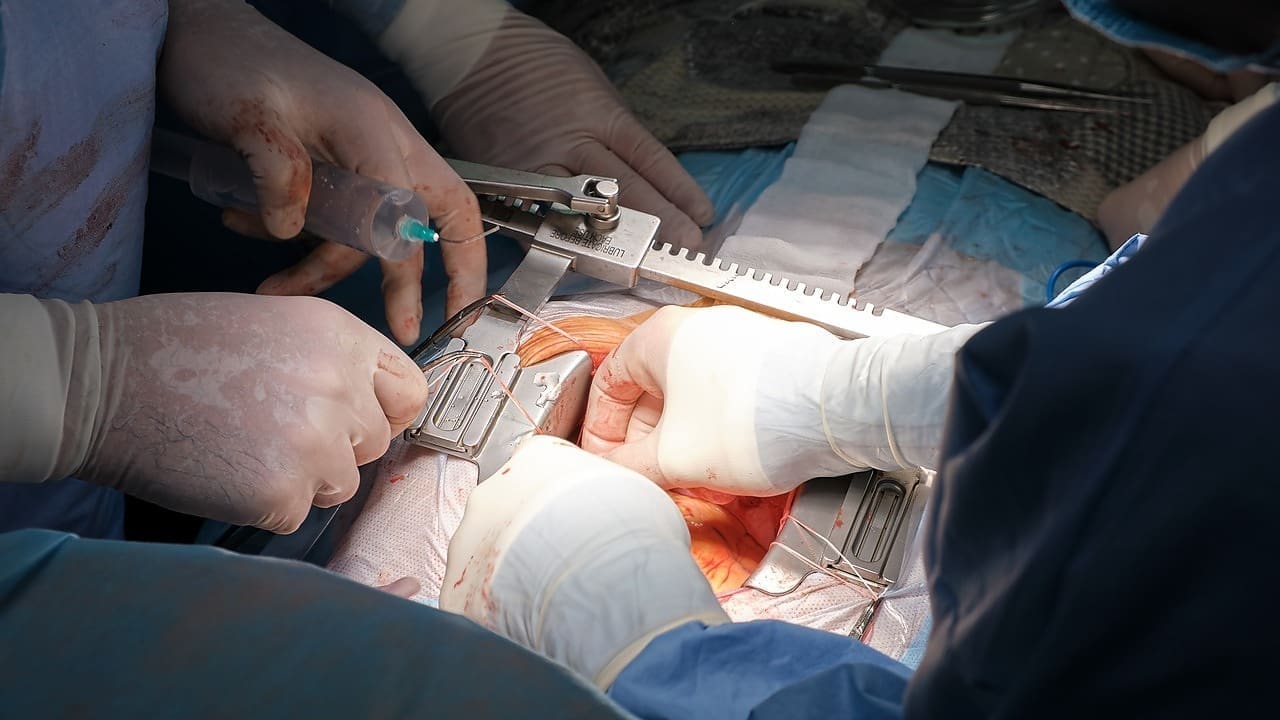 what is the hardest surgery to recover from