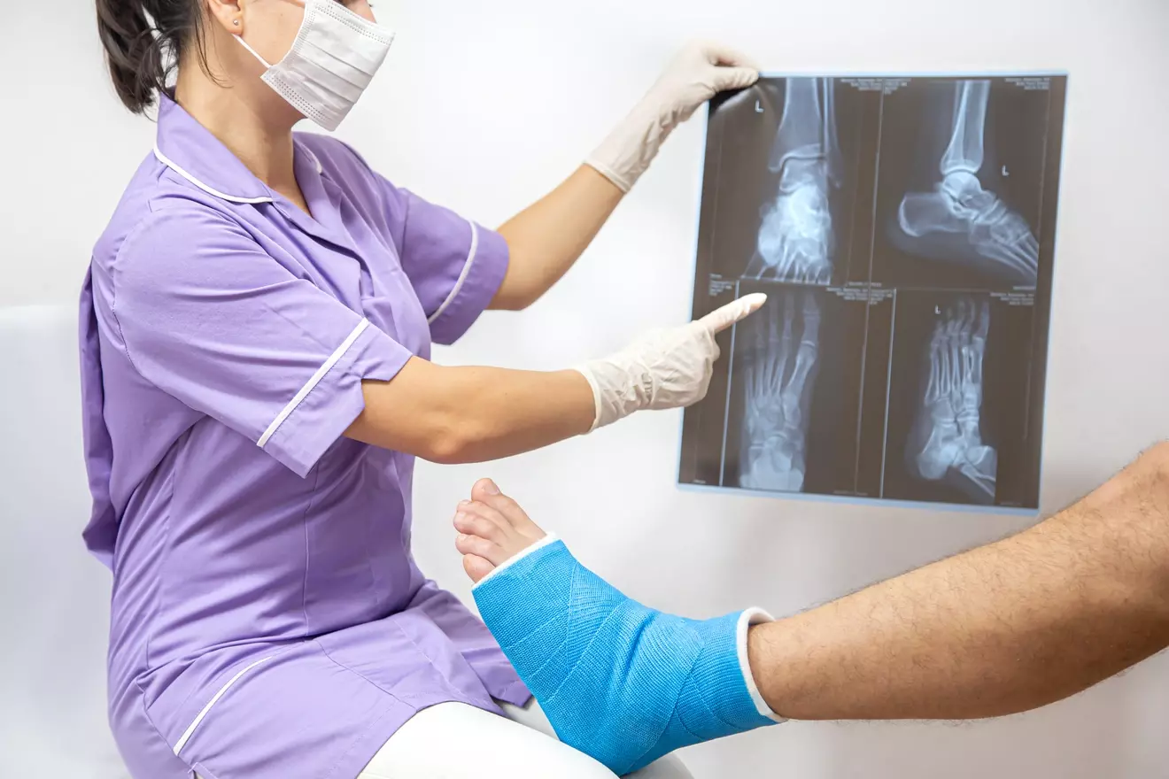 When to Get Bunion Surgery: 7 Signs It's Time to Consider Surgery