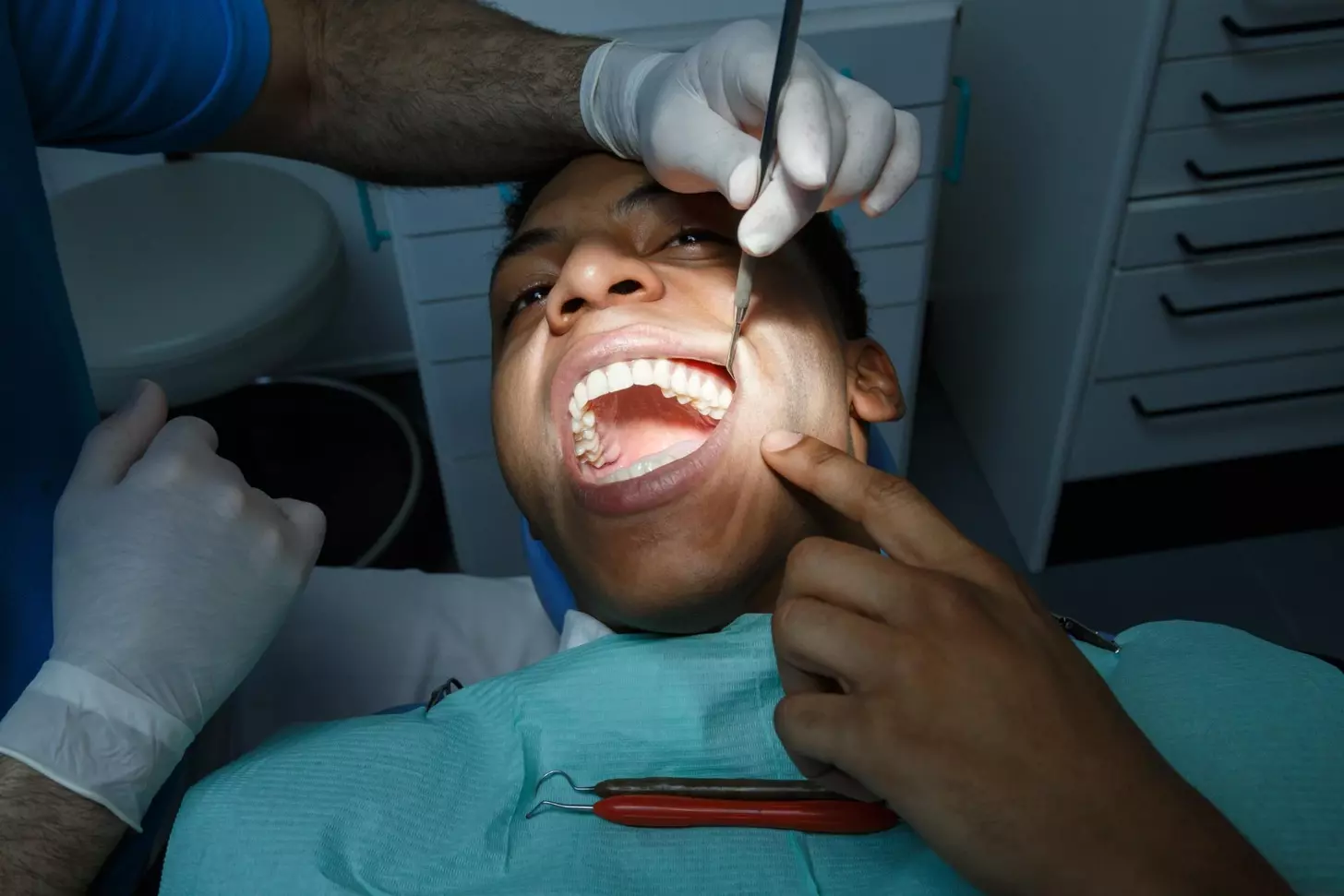 where does dental bone graft come from