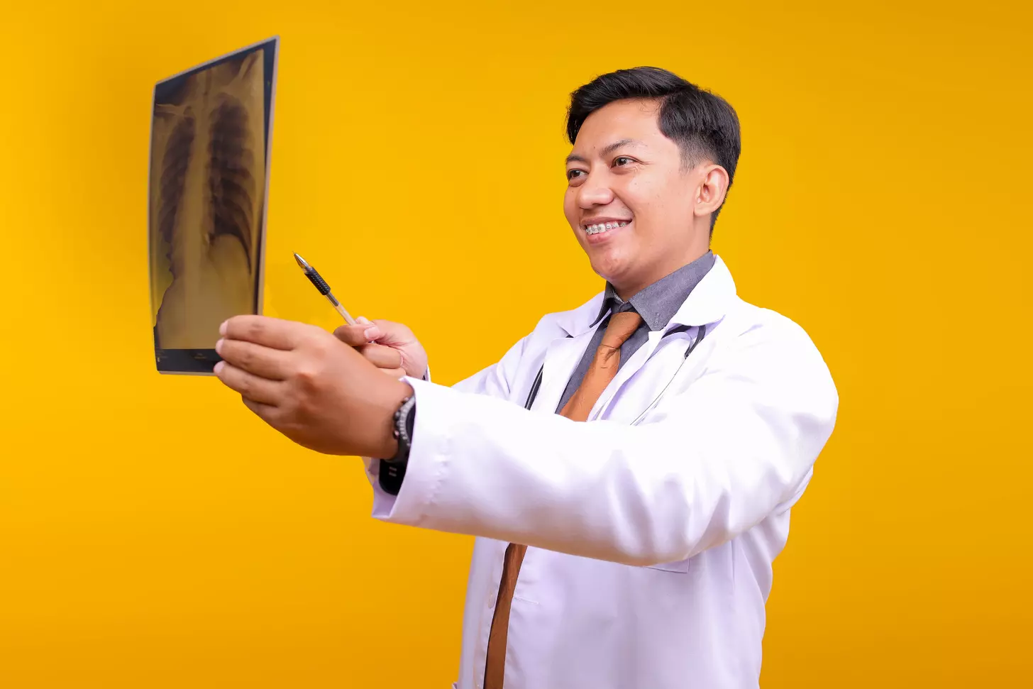 where is yellow bone marrow found