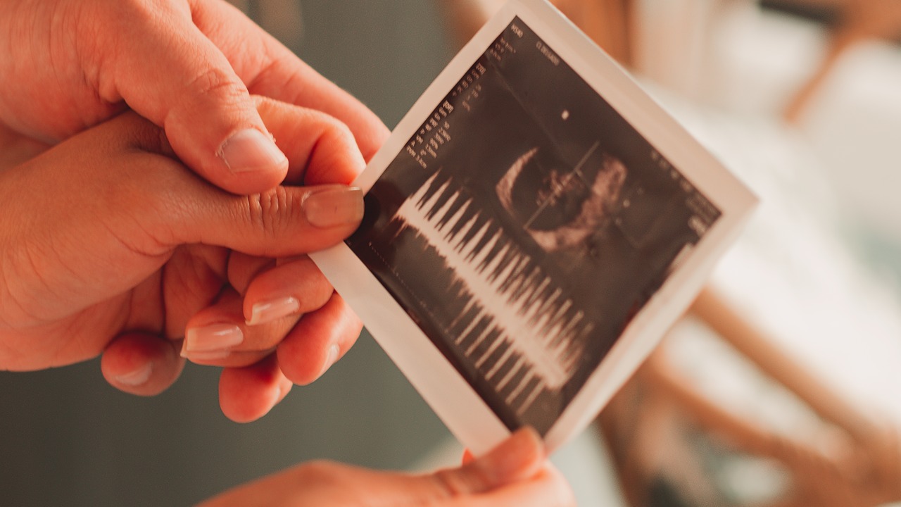 First Sonogram After IVF