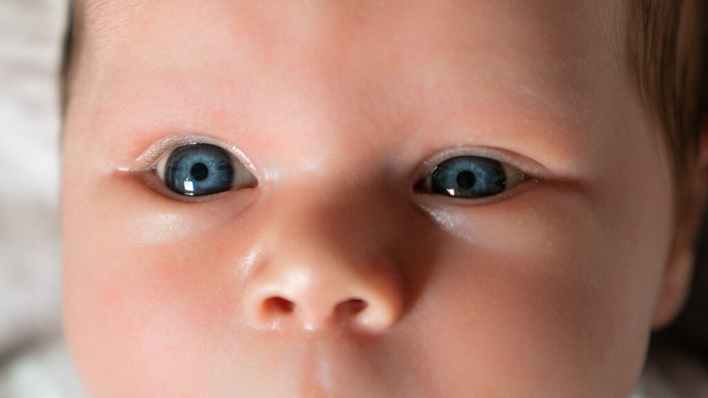 surgery for congenital ptosis