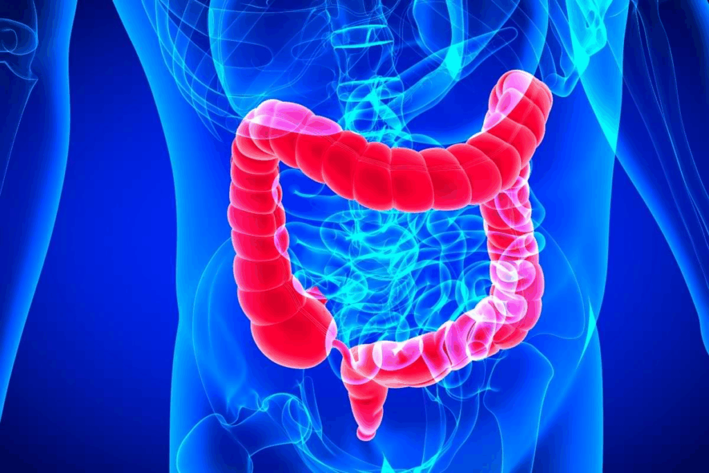 Ruptured Diverticulitis: The Shocking, Critical Signs