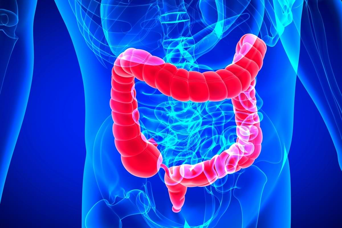 Ruptured Diverticulitis: The Shocking, Critical Signs