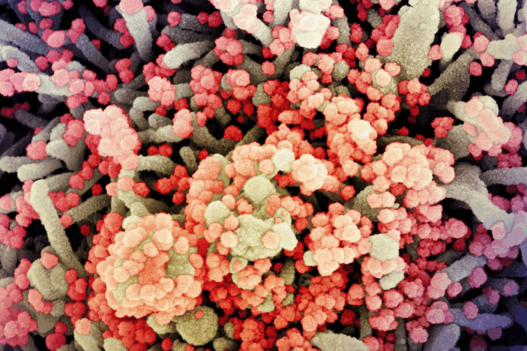 Current Viral Infections: Outbreak News