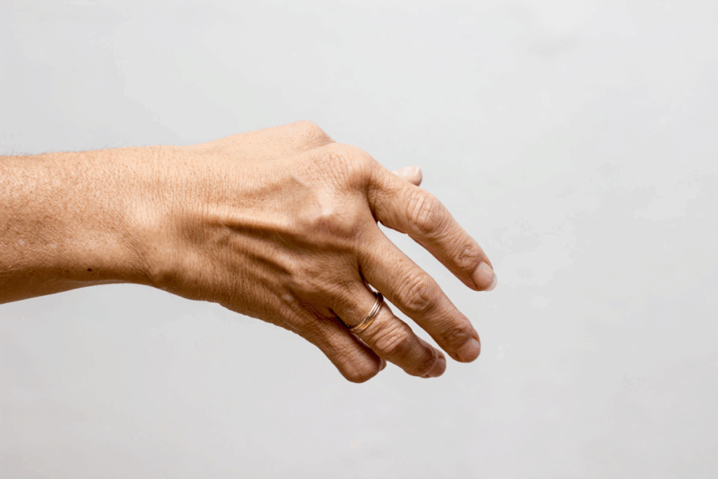 Arthritis in Finger Joints: What to Know