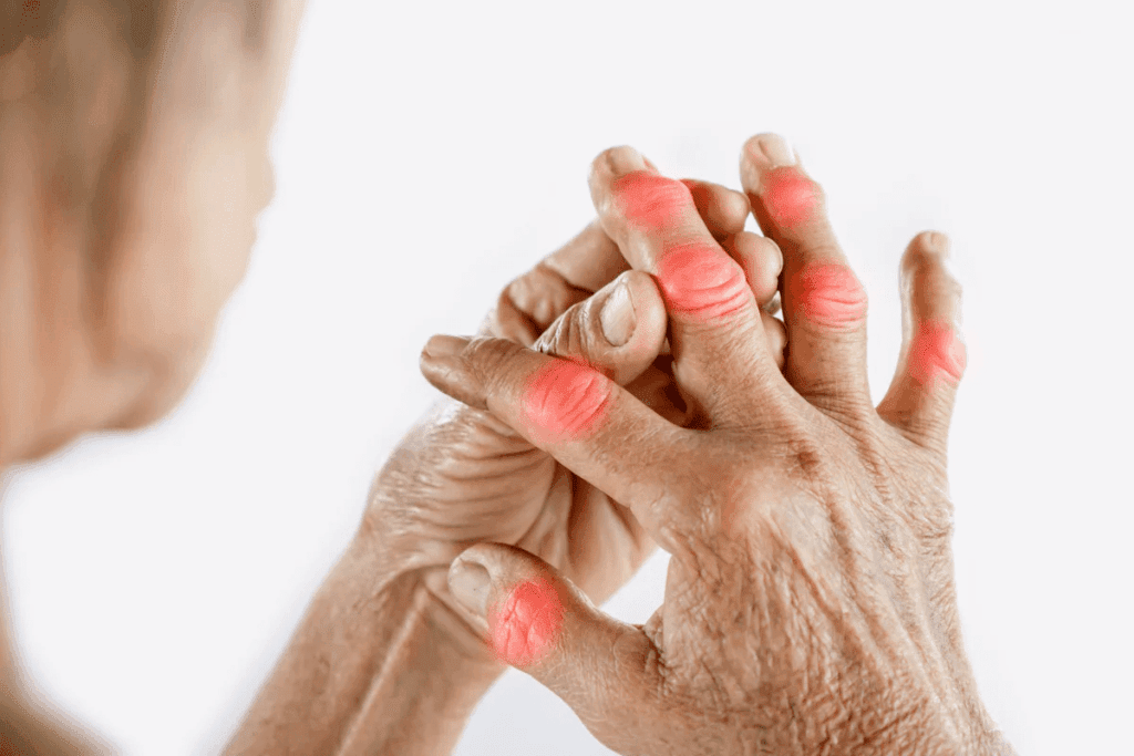 Arthritis In Your Fingers And Your Hands From Getting Worse