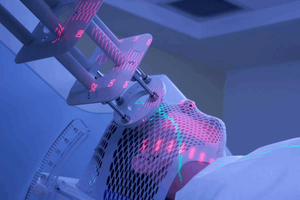 Radiotherapy How Long Is The Full Course?