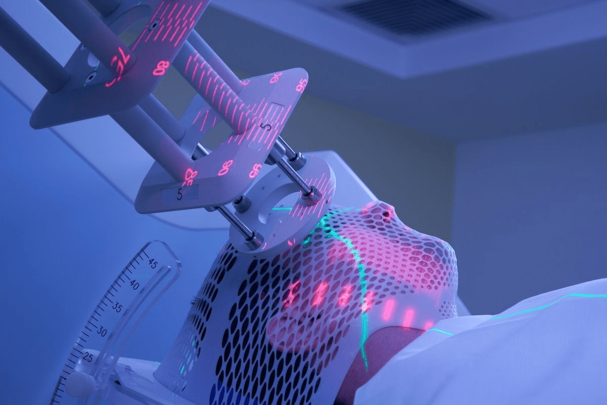 Radiotherapy How Long Is The Full Course?