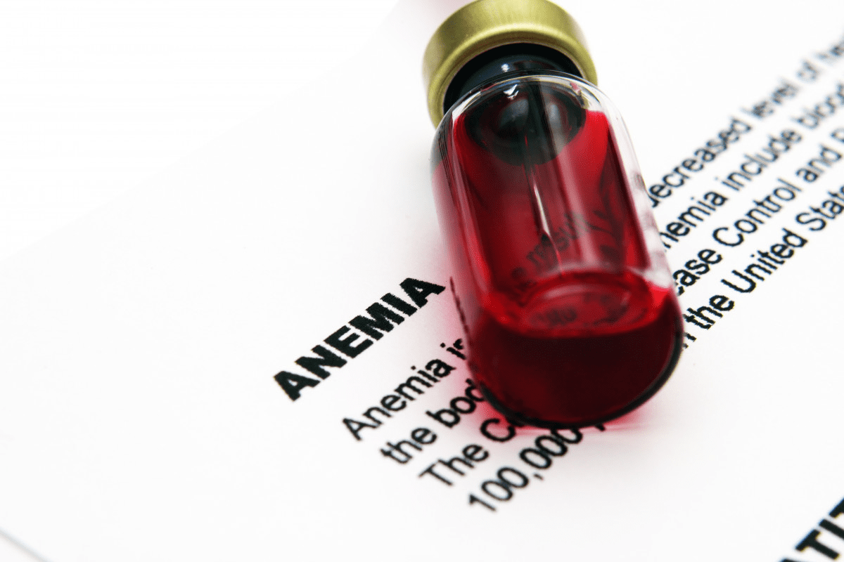 Sickle Cell Anemia Treatment: Complete Guide