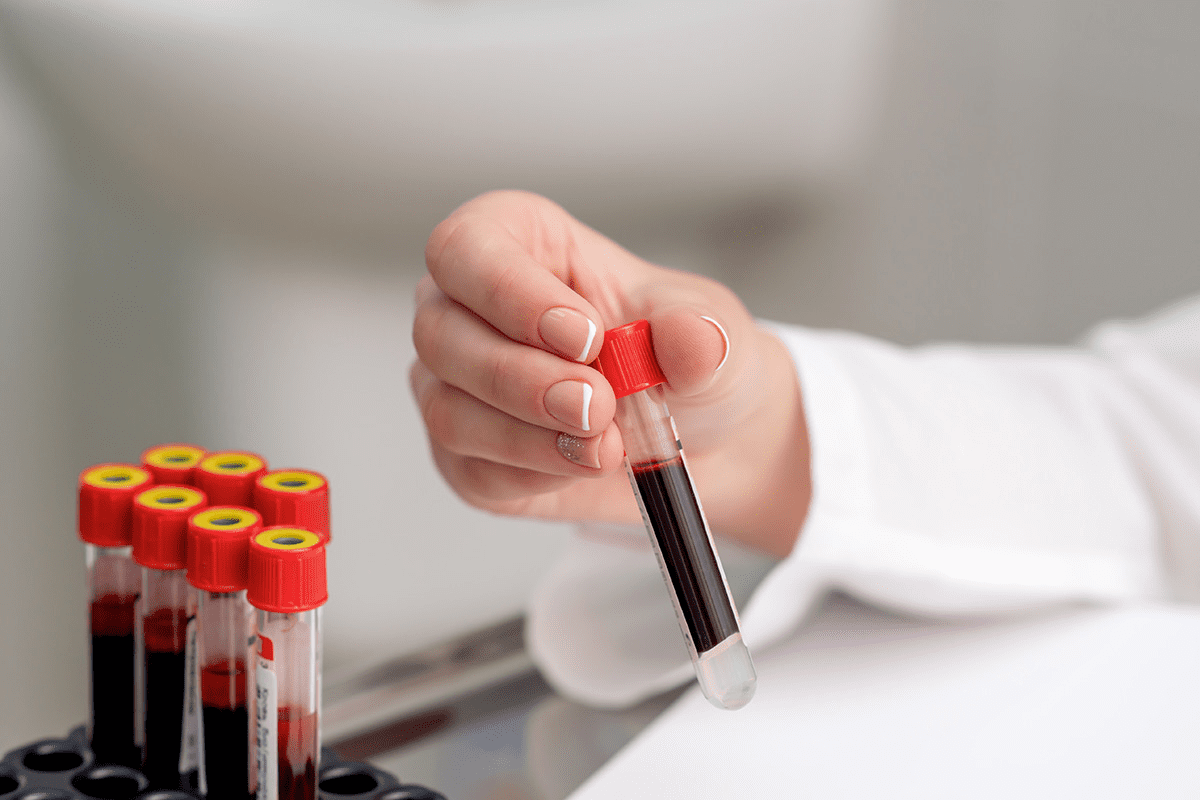 5 Essential Leukemia Treatment Tests That Confirm an Accurate Diagnosis