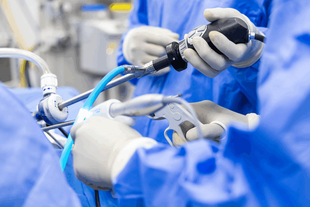 Minimally Invasive Surgery: The Ultimate Guide
