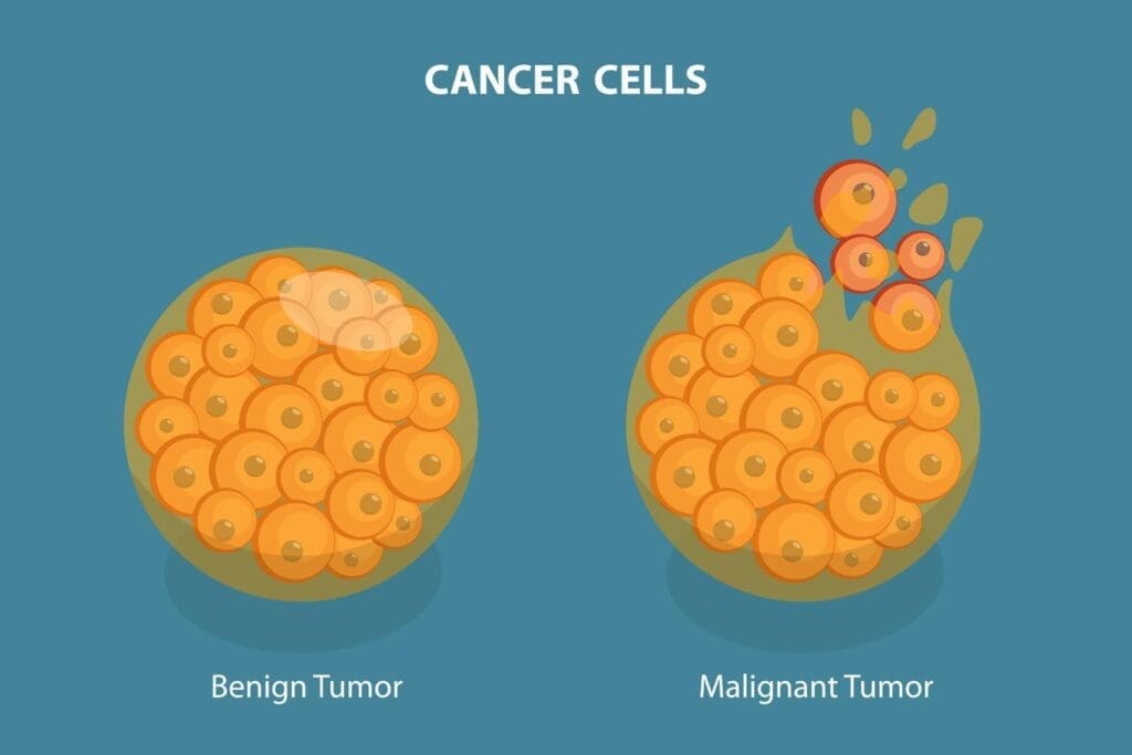 Malignant vs Benign Tumors: 7 Key Differences Explained Clearly