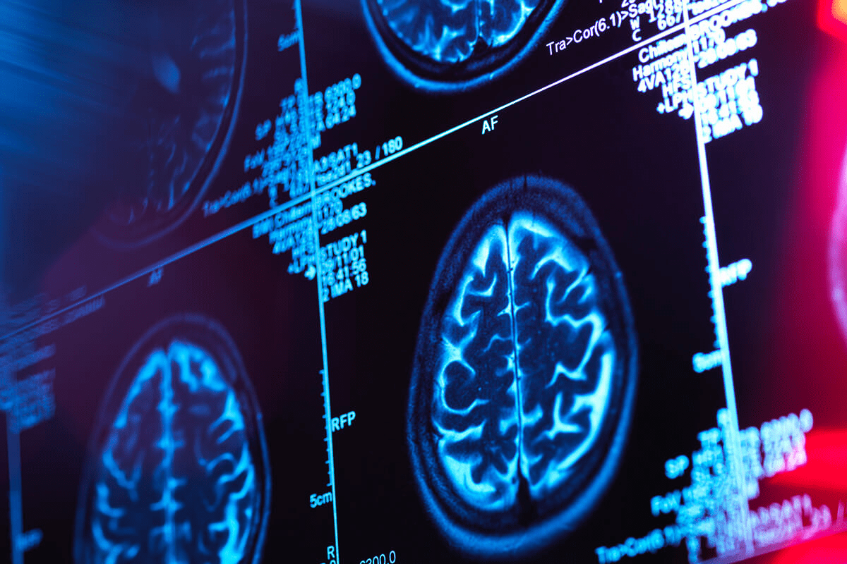 Best state neurosurgery: The ultimate rankings