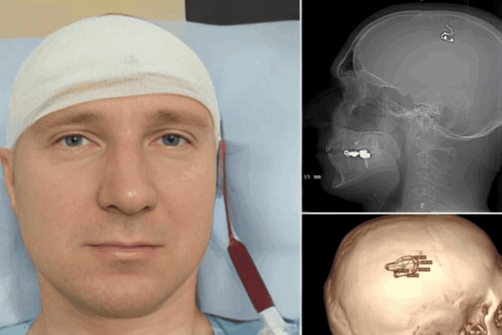 Skull base surgery complications: The awful risks