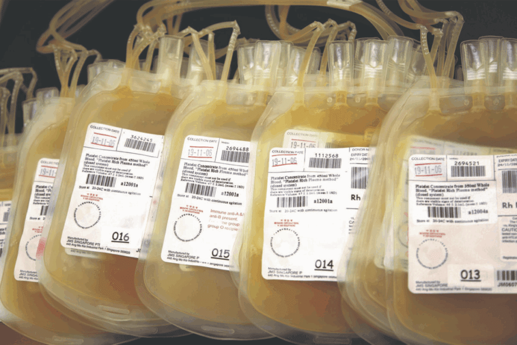 Platelet Transfusion Rate: Essential Guidelines