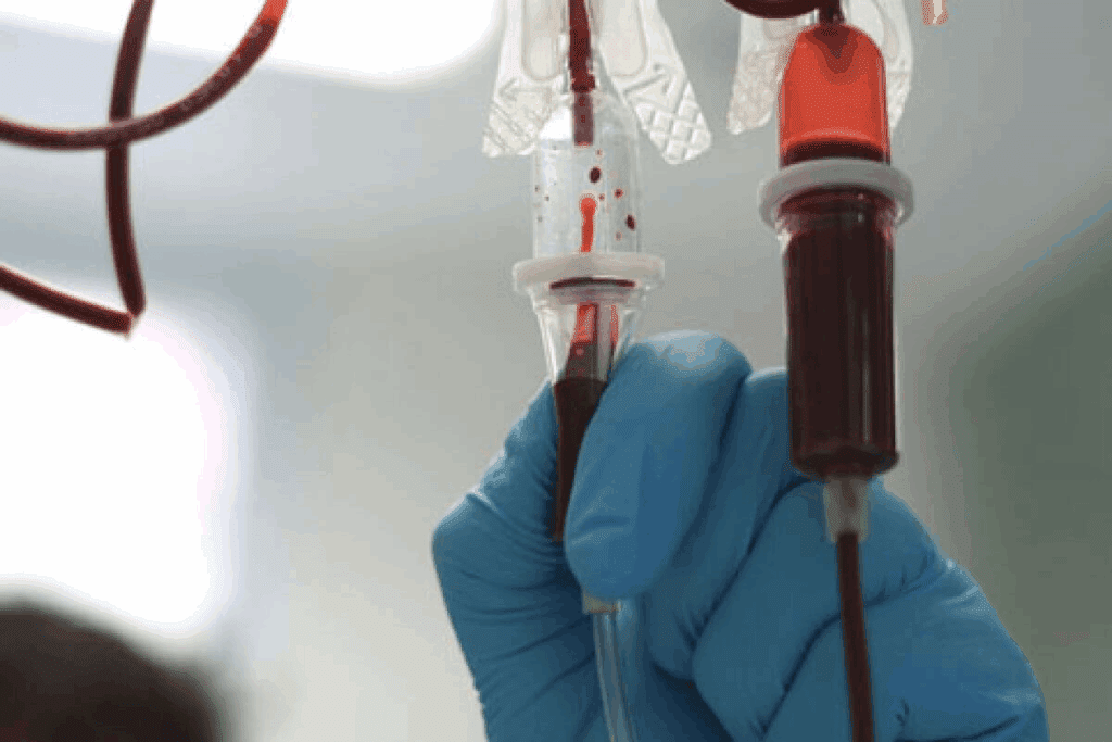 How Much Blood Is in a Transfusion: Pediatric Formula