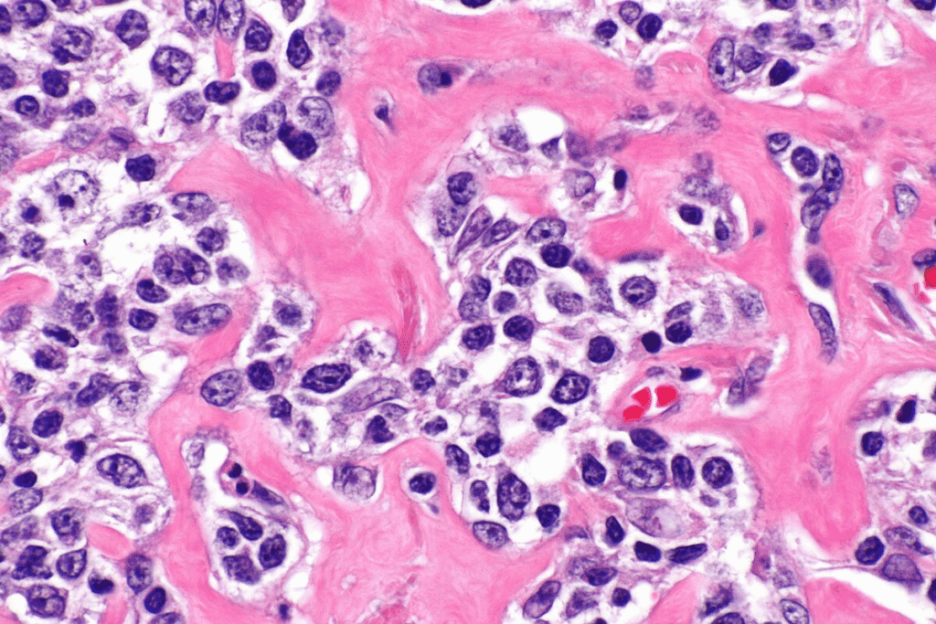 High Childhood cancer cure rates: The Success of Modern Treatment