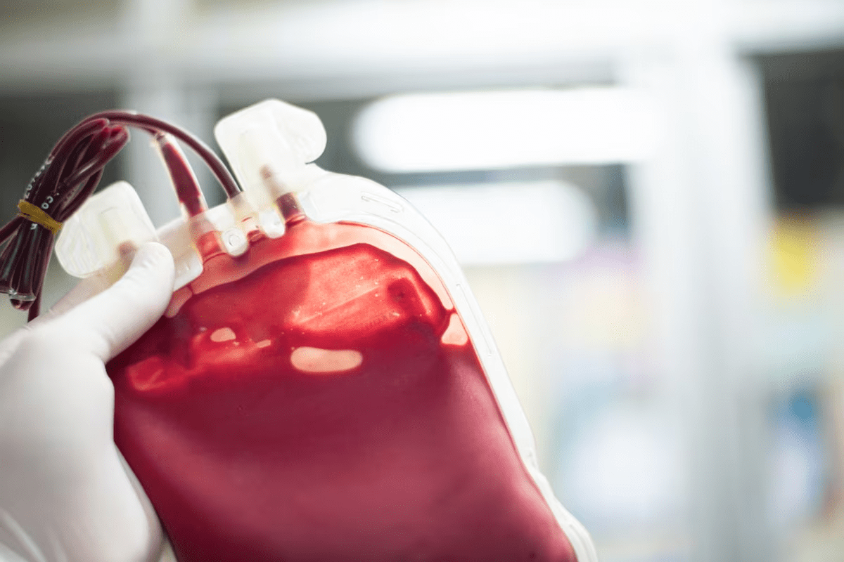 1:1:1 Rule Blood Transfusion: The Life-Saving Guideline