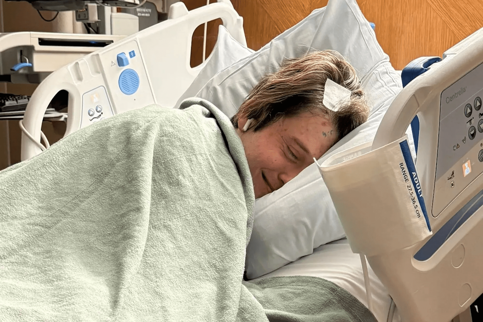 Crucial: How Fast Do Melanoma Brain Tumors Grow?