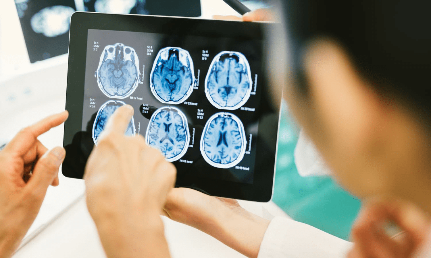 Crucial Brain Surgery And Memory Loss