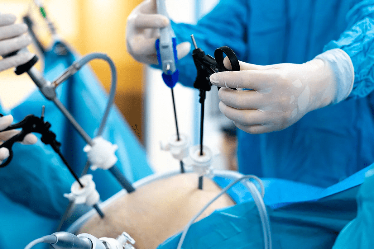 Colorectal Surgery Conditions: Common Reasons